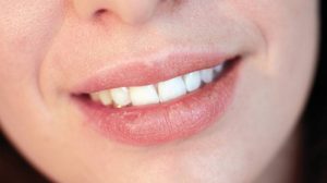 Hausmittel gegen rauhe und trockene Lippen