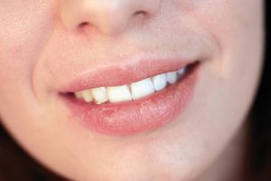 Hausmittel gegen rauhe und trockene Lippen