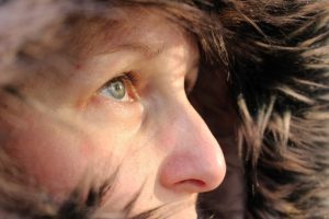 Empfindliche Haut im Winter