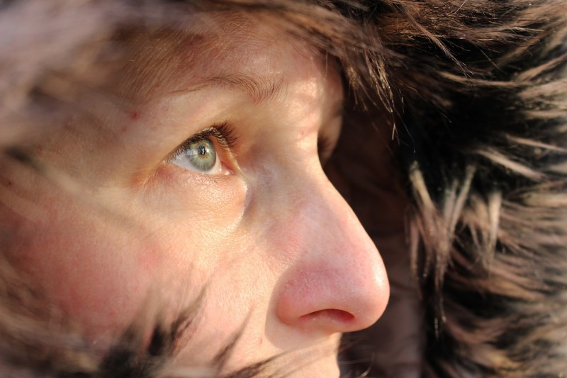 Empfindliche Haut im Winter