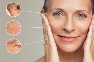 Anti-Aging Faltenbehandlung