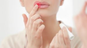 Hausmittel gegen Herpes