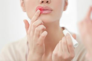 Hausmittel gegen Herpes